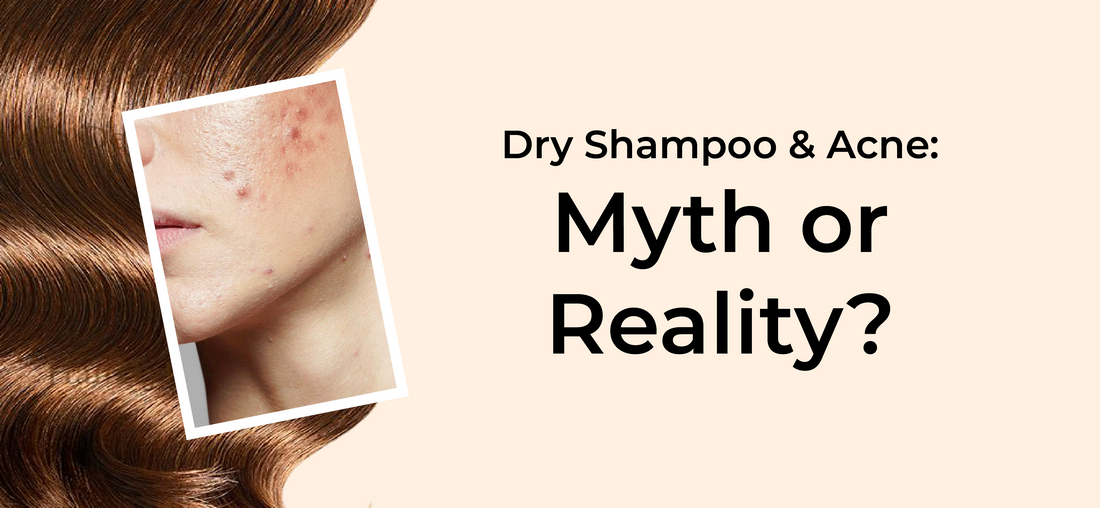 Will using dry shampoo cause acne? - Epitight