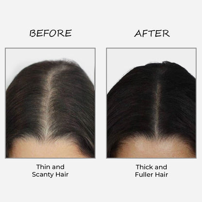 Epitight Thicc Hair Transform Scanty Hair To Thick & Fuller Hair | With 2x Heat Protection 200 ML