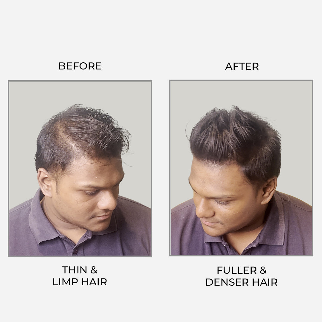 Epitight Thicc Hair Transform Scanty Hair To Thick & Fuller Hair | With 2x Heat Protection 200 ML
