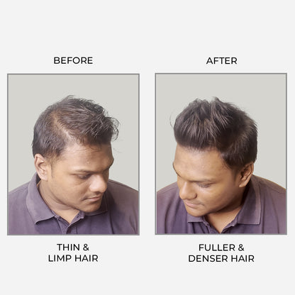 Epitight Thicc Hair Transform Scanty Hair To Thick & Fuller Hair | With 2x Heat Protection 200 ML