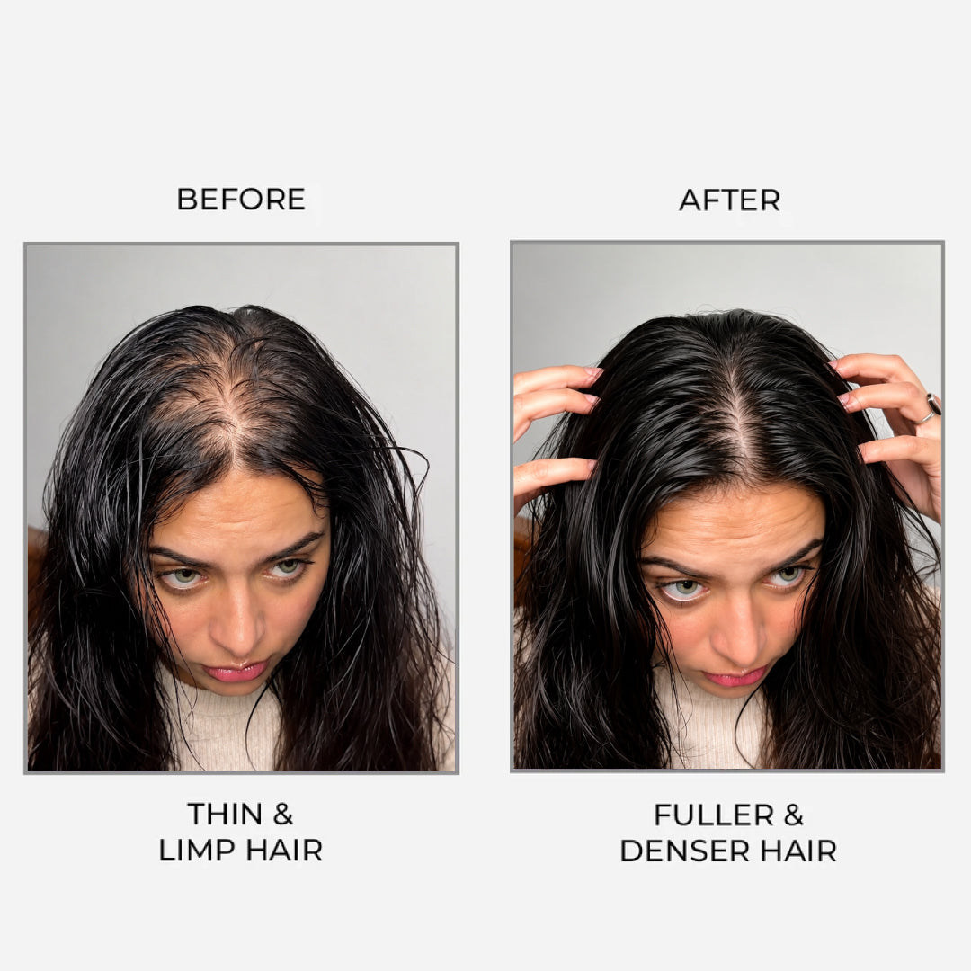 Epitight Thicc Hair Transform Scanty Hair To Thick & Fuller Hair | With 2x Heat Protection 200 ML