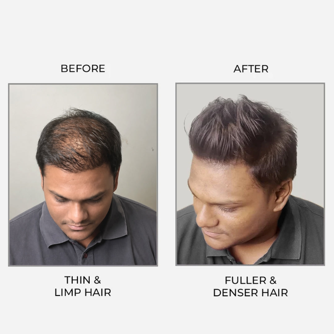 Epitight Thicc Hair Transform Scanty Hair To Thick & Fuller Hair | With 2x Heat Protection 200 ML