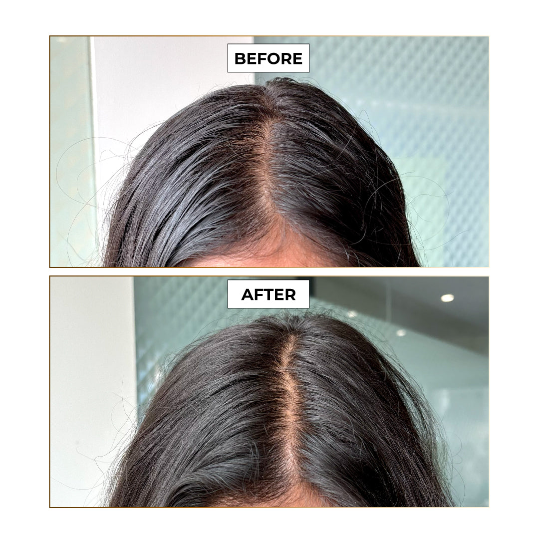 Epitight Dry Shampoo