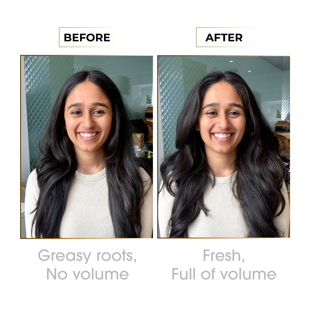 Epitight Dry Shampoo