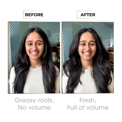 Epitight Dry Shampoo