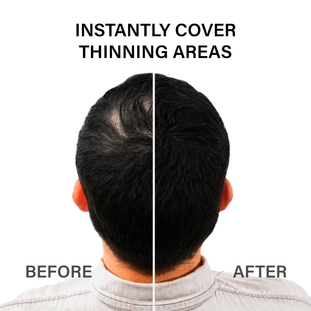 Epitight Hair Fibers |12g