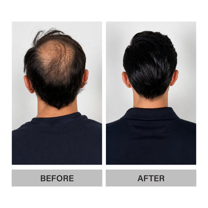 Epitight Hair Confidence Kit