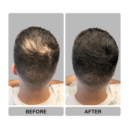 Epitight Hair Fibers |12g