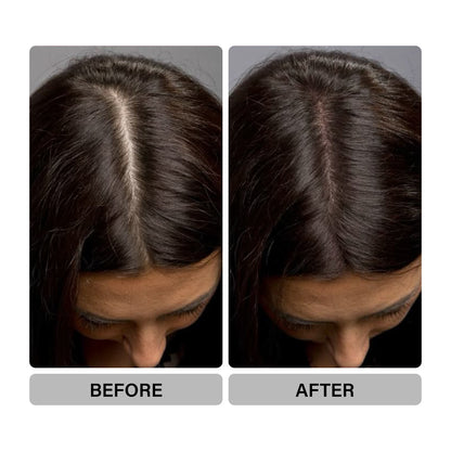Epitight Hair Fibers |12g