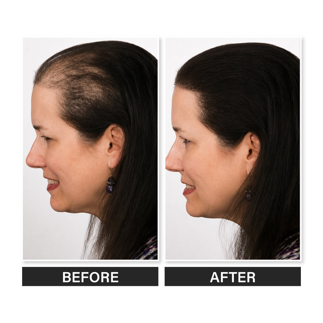 Epitight Hair Mud | 6g