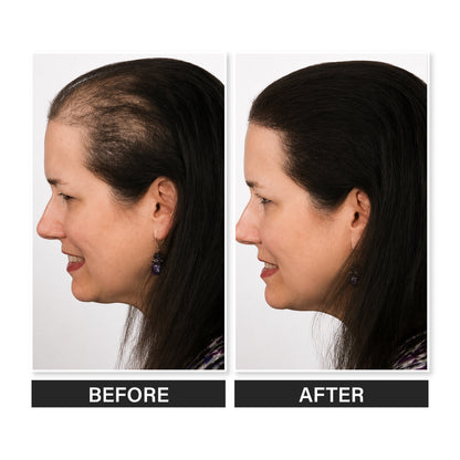 Epitight Hair Mud | 6g