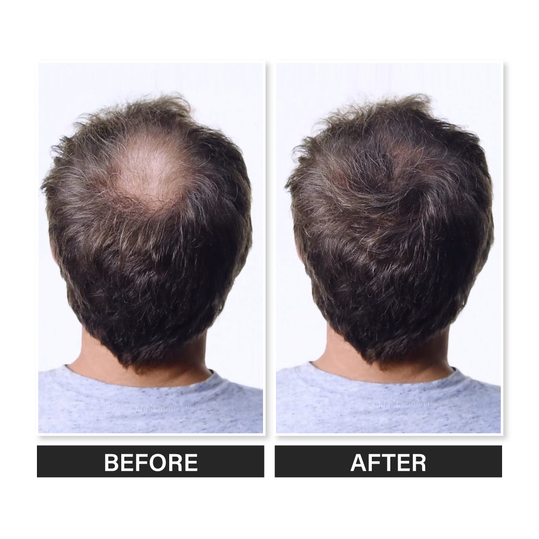 Epitight Hair Mud | 6g