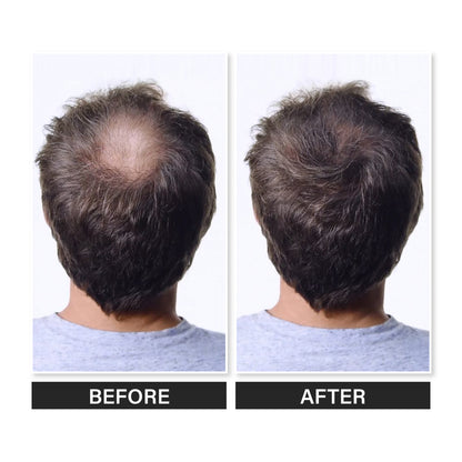 Epitight Hair Mud | 6g
