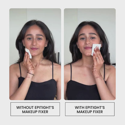 Epitight WaterProof Makeup Fixer (130ml)